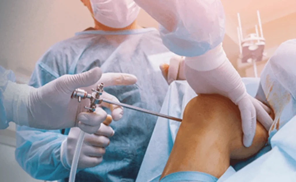 best knee arthroscopic in indore, best knee replacement surgeon in indore,